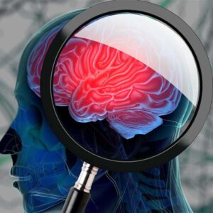 Alzheimers Disease and Other Dementias