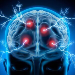 Epilepsy