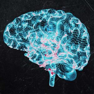 Parkinsons Disease